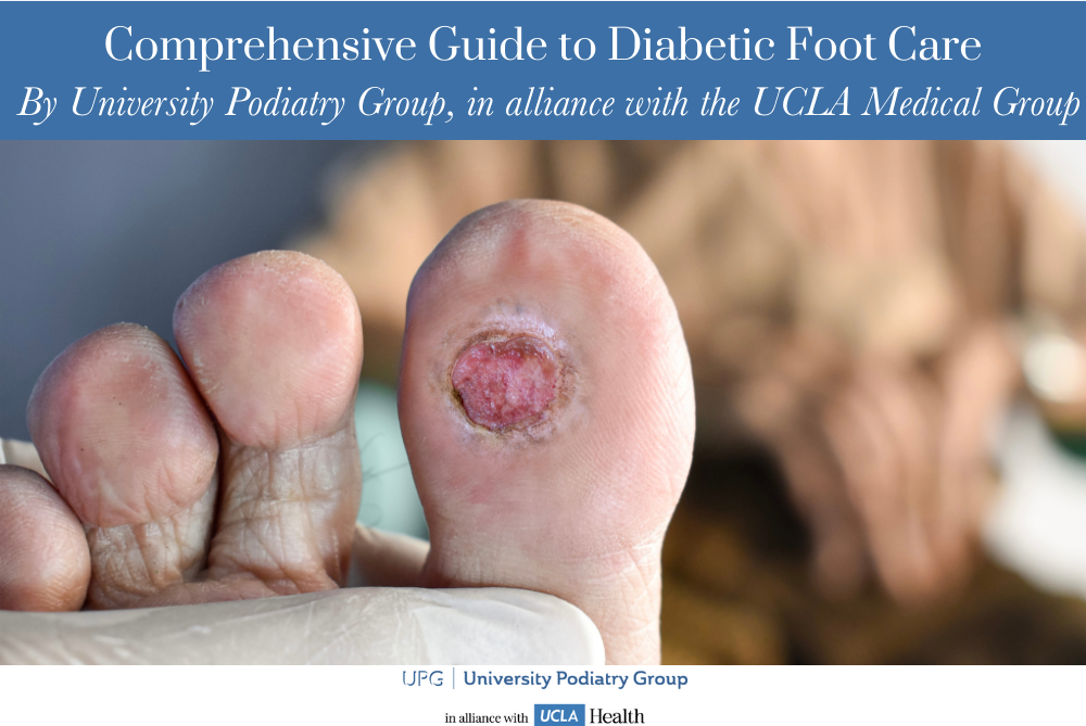 Comprehensive Guide to Diabetic Foot Care