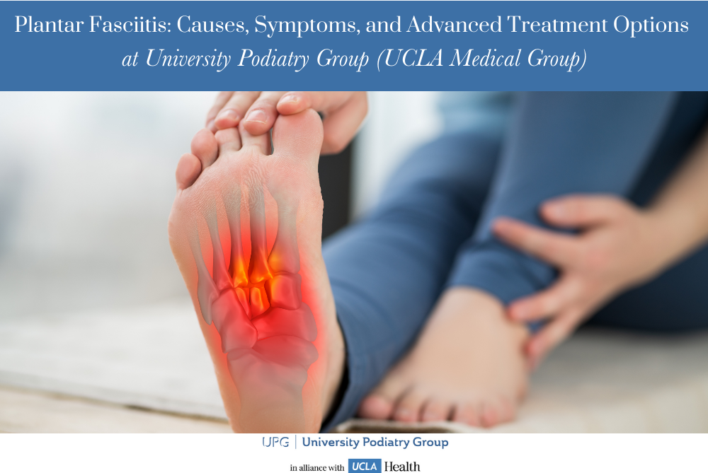 Plantar Fasciitis Causes, Symptoms, and Advanced Treatment Options at University Podiatry Group (UCLA Medical Group)